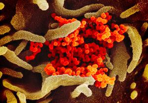 Nuevo análisis para detectar coronavirus daría paso a realizar pruebas en masa