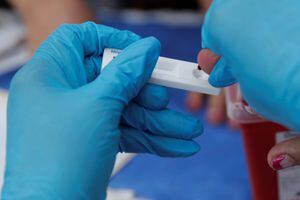 Vacuna para prevenir el VIH puede estar disponible en unos cuatro años