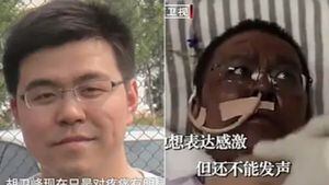 Fallece uno de los médicos chinos que cambió de color al contraer coronavirus