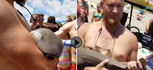 Vídeo: Homem é atacado por tubarão e precisa caminhar com animal preso no braço em busca de socorro