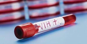 ¿Cómo es el innovador tratamiento que curó a una segunda persona de VIH?