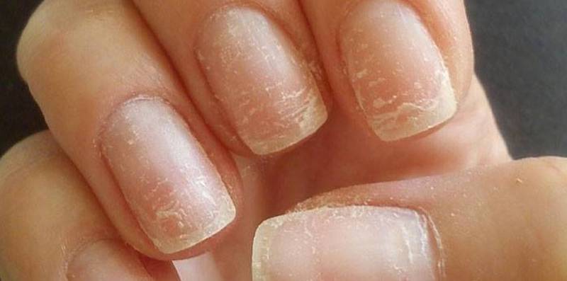 Algunos productos químicos de mala calidad afectan las uñas.