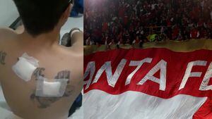 ¡Impactante testimonio de presunto hincha de Millonarios herido por barras de Santa Fe!