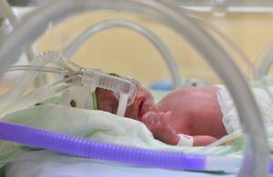 Bebé recién nacido muere por quemaduras sufridas en incubadora