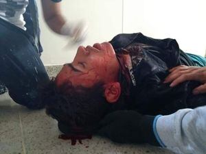 Estudiante de la Universidad del Cauca resultó gravemente herido por el Esmad