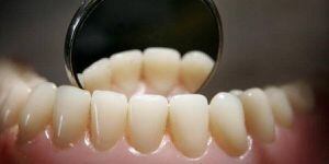 Estudio revela que el 74% de los hombres que no se cepillan bien los dientes sufre de impotencia