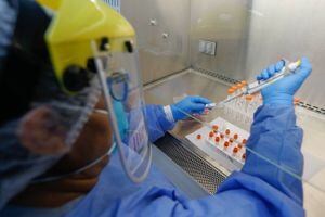 Minsal reporta 57 fallecidos y 1.770 casos nuevos de coronavirus en el país las últimas 24 horas