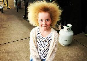 El rarísimo "síndrome del cabello impeinable" que transformó a esta niña en la reina de Instagram