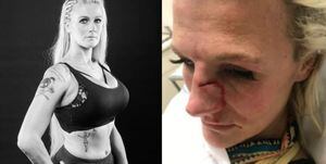 Peleadora de MMA es golpeada brutalmente por su pareja