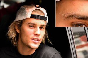¡Justin Bieber se hizo un tatuaje en la cara! Y sería en homenaje a su esposa Hailey Baldwin
