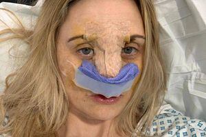 Mulher que fingiu doença mental para fazer cirurgia plástica de graça inicia crowdfunding para levantar o bumbum