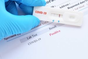 COVID-19: Salud reporta once muertes y 227 casos adicionales