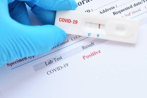 Suben a 86 las muertes por coronavirus en Puerto Rico