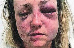 Salvaje ataque: agredió sexualmente a su pareja, le lanzó amoníaco a los ojos y luego la retuvo por horas para prolongar su dolor