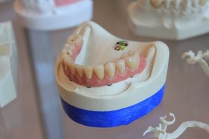 Conozca 10 mitos y verdades sobre la salud dental