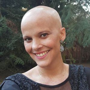 Melanoma: El peligroso cáncer que afectó a Javiera Suárez