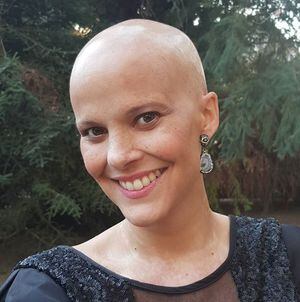 Melanoma: El peligroso cáncer que afectó a Javiera Suárez