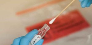 Anticoagulantes mejoran un 50% la supervivencia de los pacientes con COVID-19