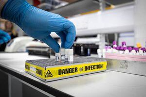 Medicamento puede matar el coronavirus en 48 horas en pruebas "in vitro"