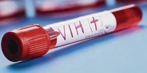 Vacuna contra el VIH empezará a ser probada este año