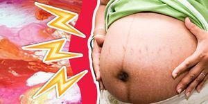 6 formas en las que el embarazo cambia tu cuerpo para siempre
