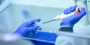 7230 nuevos casos de coronavirus se reportaron este lunes