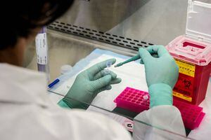 Otro plan medico cubrirá el costo de las pruebas de coronavirus para sus pacientes