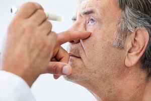 Glaucoma: ¿Qué es y cómo prevenir esta enfermedad que afecta al nervio óptico?