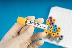 Coronavirus COVID-19 sí tendrá cobertura del sector de seguros