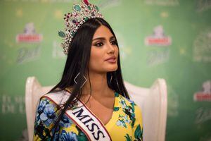 Difunden fotos de Miss Venezuela antes de las cirugías