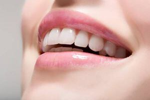 Tik Tok: la peligrosa tendencia que puede causar daño en los dientes