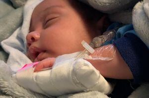 Padres imploran ayuda ante rara condición de bebé que necesita urgente transplante