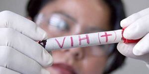 El VIH-sida se alimenta de la crisis venezolana