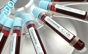 Azitromicina con hidroxicloroquina, combinación prometedora contra Covid-19 aseguran médicos franceses