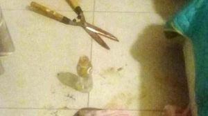El violento ataque que impacta a Argentina: mujer le cortó el pene y los testículos a su novio con una tijera de podar