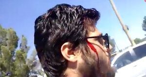 "Mereces ser violada": predicador es golpeado con un bate de béisbol por denigrante y violento cartel