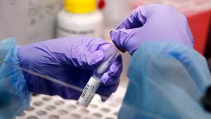 Rusia termina pruebas clínicas de una vacuna contra el coronavirus