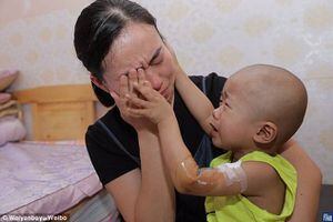 "No llores": niño con cáncer consuela a su madre tras quedar sin dinero para pagar tratamiento