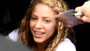 Fans publican foto de Shakira antes de operarse la nariz