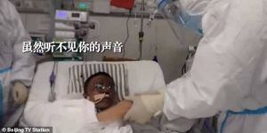 El extraño cambio en el color de la piel de médicos sobrevivientes de Wuhan