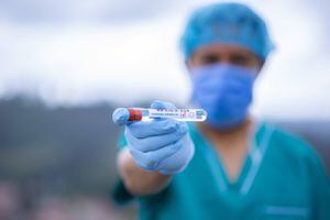 COVID-19: Salud reporta 278 casos nuevos entre confirmados y probables