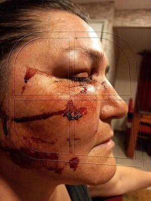 "'Mariconas', 'sucias', 'cochinas'": Mujer relata despiadada agresión lesbofóbica que la dejó con pérdida de consciencia