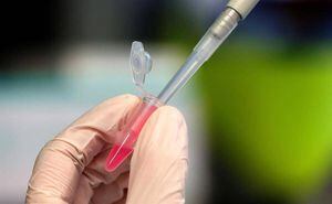 Oxford ya produce vacunas contra el coronavirus, ¿cuándo las venderían?