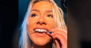 Dentistas alertam sobre vídeos de pessoas usando lixa de unha nos dentes