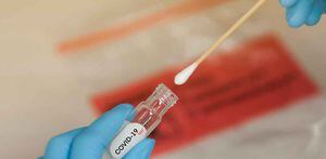 Chile detecta y pone en alerta sobre una cepa muy rara de coronavirus