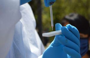 Coronavirus en Ecuador: 38.471 casos confirmados y 3.313 fallecidos por COVID-19