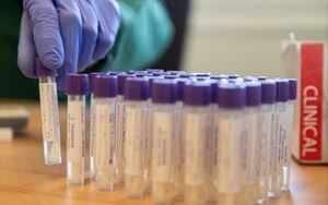 Así se hacen las tomas de prueba de coronavirus a pacientes sospechosos