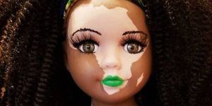 Estas muñecas con vitiligo resaltan de forma única la belleza detrás de esta condición