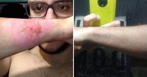 (VIDEO) Hombre se hizo tatuaje, se arrepintió del resultado y se lo borró con un rallador de cocina