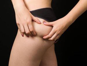 Ejercicios que puedes hacer desde tu cama para reducir la celulitis de los muslos